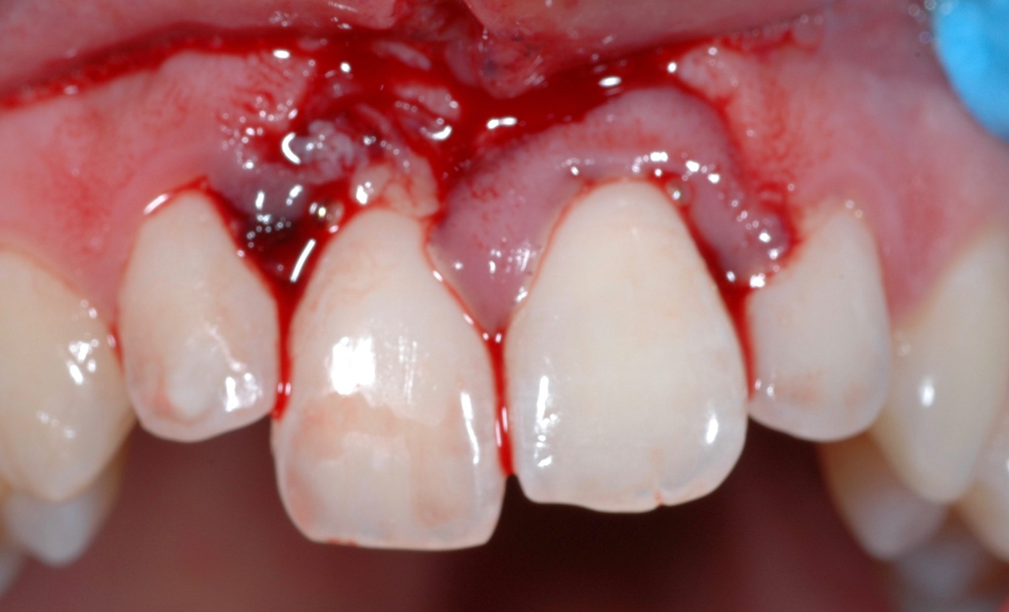 Moved International Association of Dental Traumatology