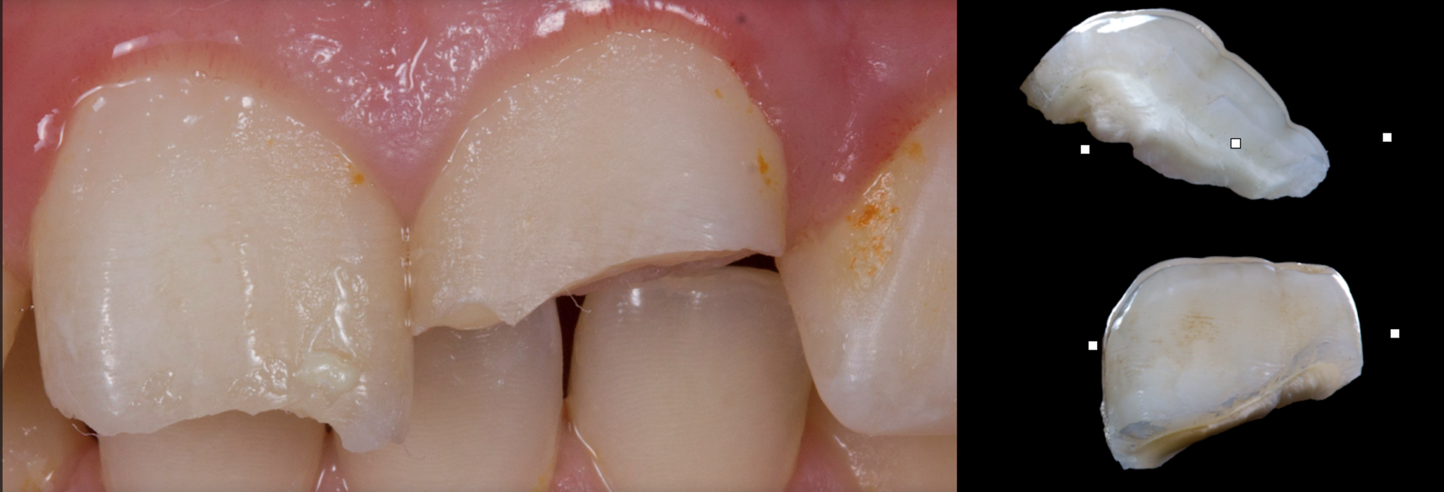 Prevention and Emergency Care – International Association of Dental ...